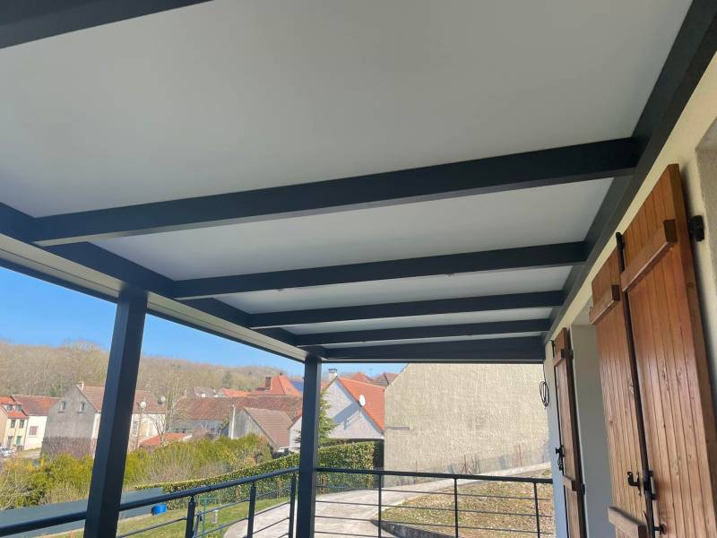 Modulare Aluminium-Pergola: Außengestaltung in Ettelbruck